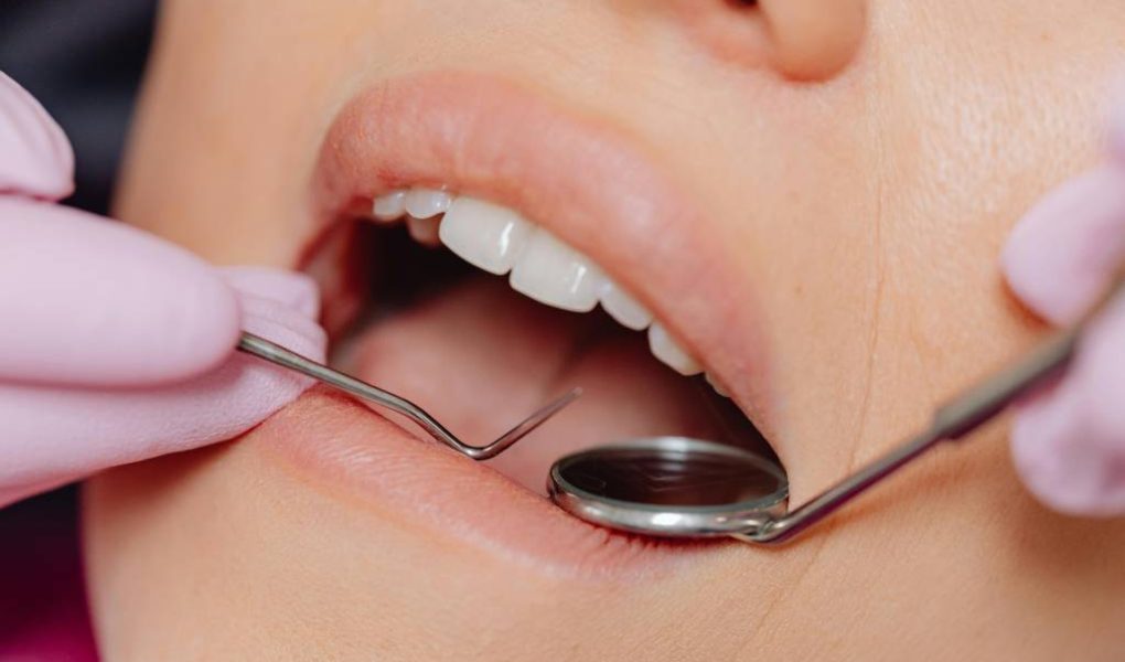 Les avantages de consulter un dentiste local à Bayonne