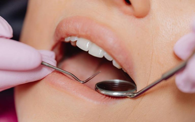 Les avantages de consulter un dentiste local à Bayonne