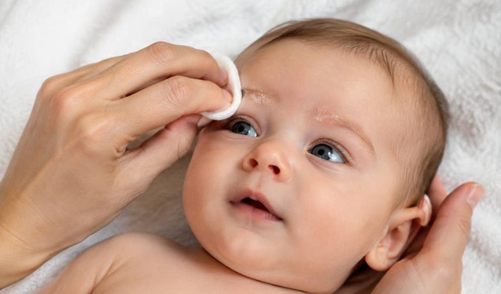 Croûtes de lait sourcils : soins doux et produits adaptés pour bébé