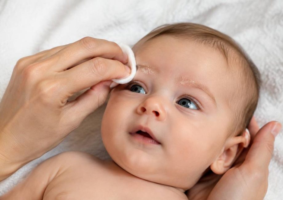 Croûtes de lait sourcils : soins doux et produits adaptés pour bébé