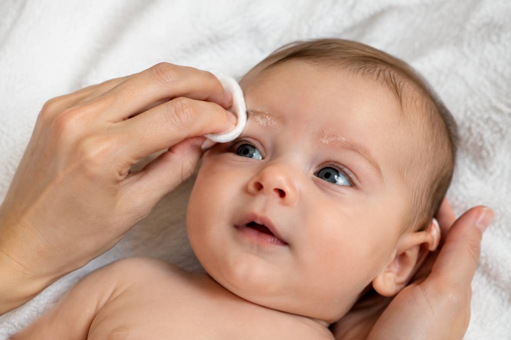 Croûtes de lait sourcils : soins doux et produits adaptés pour bébé